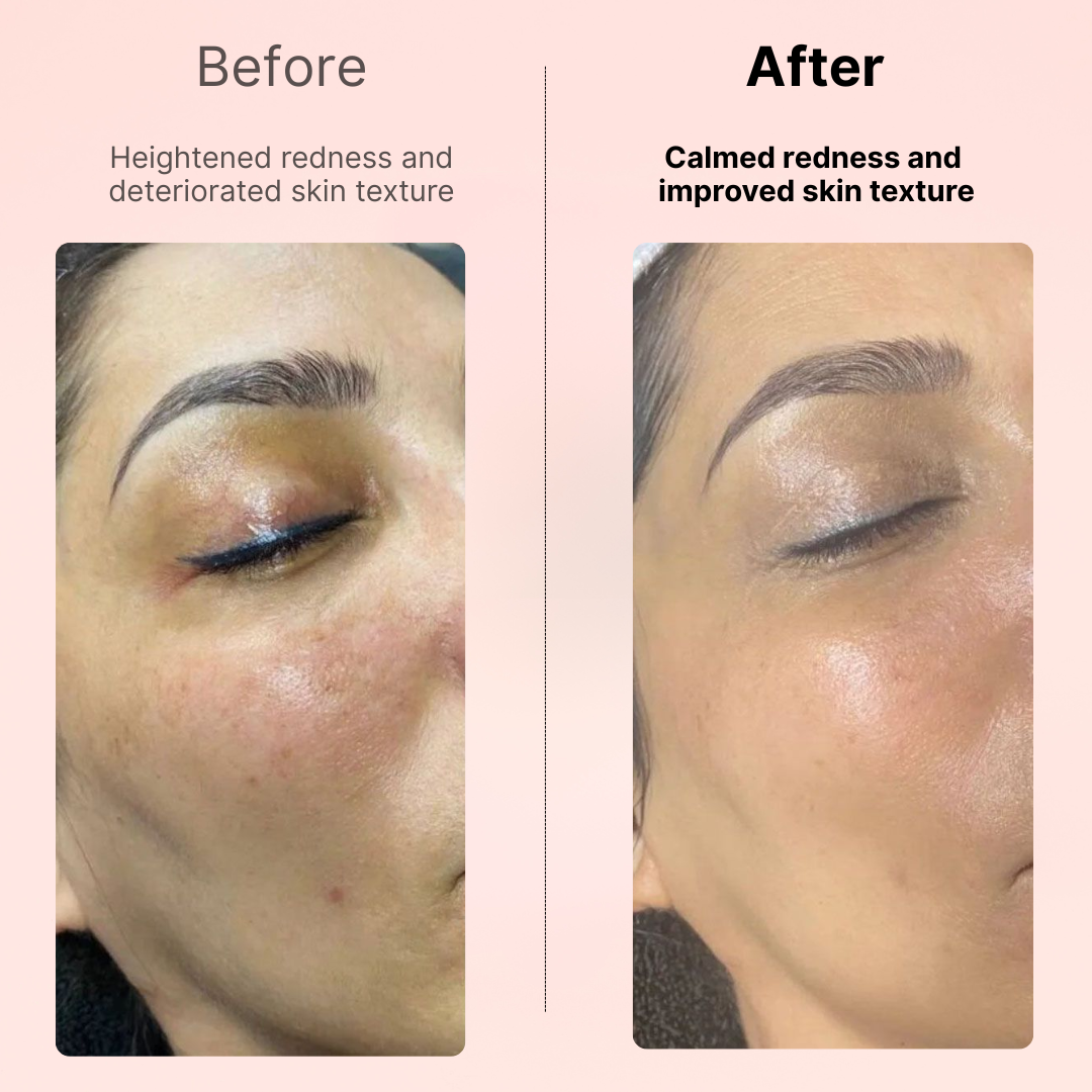 GlowBiome™️ Triple Collagen Mask (4 pcs)