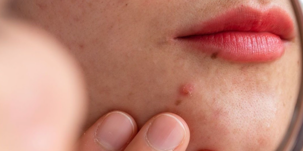 Post-Sun Repair for GCC: Calm, Rehydrate, and Even Tone