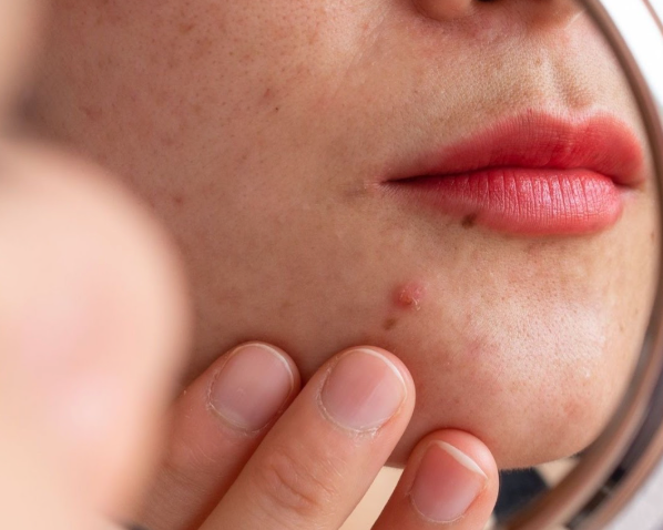 Post-Sun Repair for GCC: Calm, Rehydrate, and Even Tone