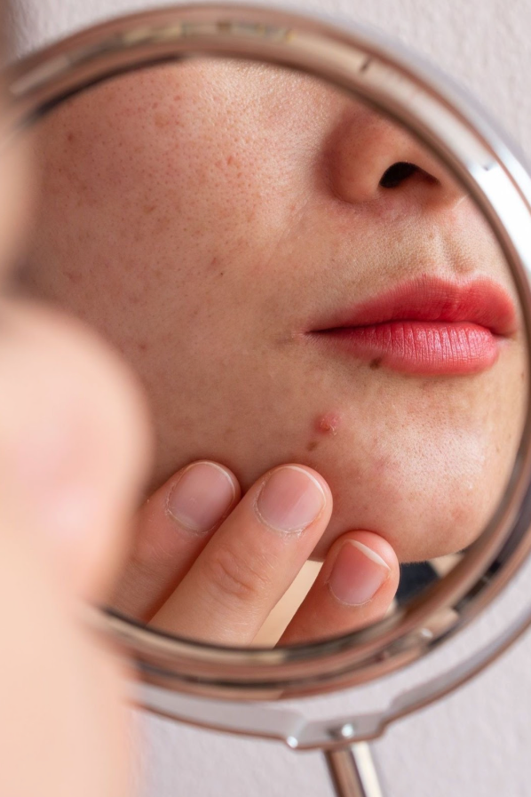 Post-Sun Repair for GCC: Calm, Rehydrate, and Even Tone